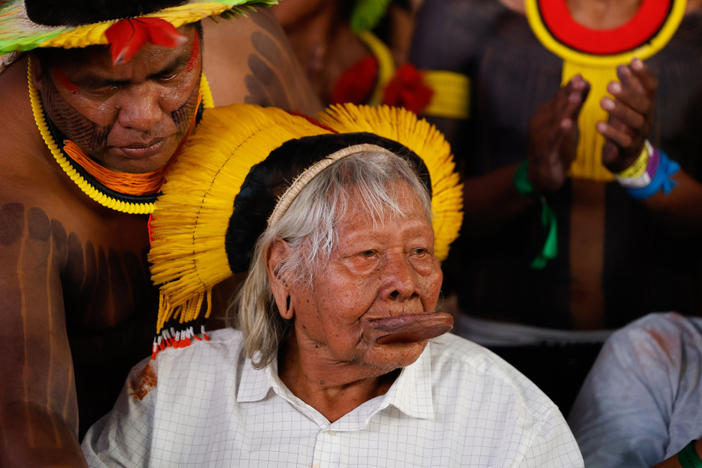 cacique-raoni-tem-melhora-da-tosse-e-evolui-na-recuperacao-apos-hemorragia