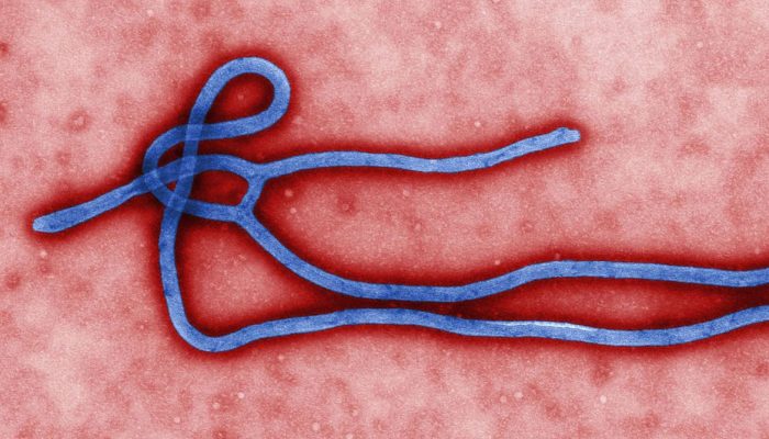 rio-grande-do-sul-investiga-caso-suspeito-de-ebola