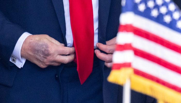 ‘negros-nao-sao-macacos’:-congressista-exibe-cartaz-durante-discurso-de-trump